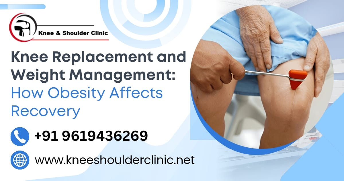 Knee Replacement and Weight Management: How Obesity Affects Recovery