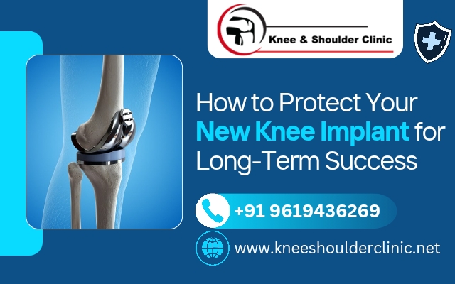 How to Protect Your New Knee Implant for Long-Term Success