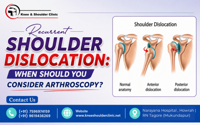 Recurrent Shoulder Dislocation: When Should You Consider Arthroscopy?